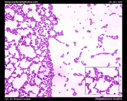 streptococcus mutans micrograph